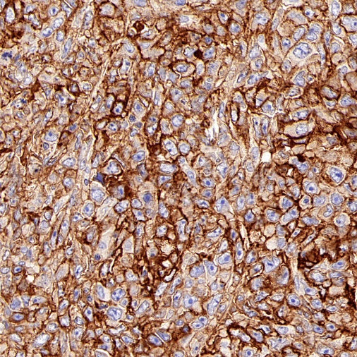 CD44v6 Mouse mAb (S-945-76)