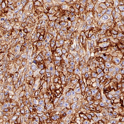 CD44v6 Mouse mAb (S-945-76)