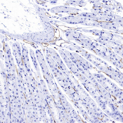 PODXL Recombinant Rabbit mAb (S-2014-9)