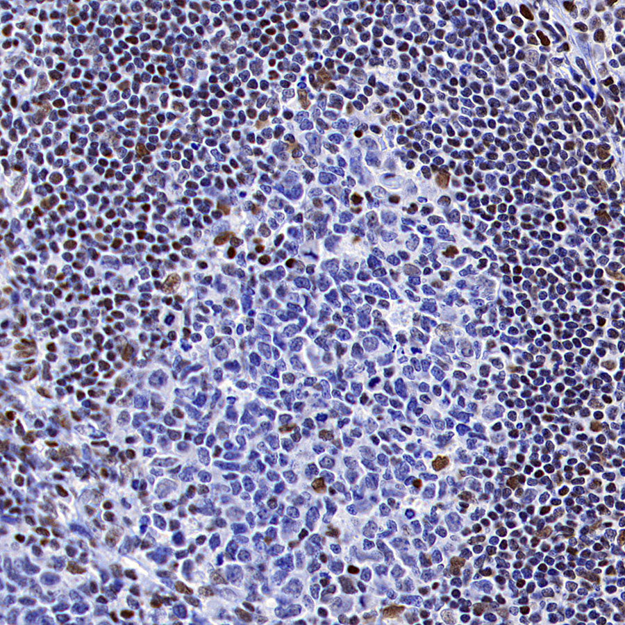 Bmi1 Recombinant Rabbit mAb (S-5143)