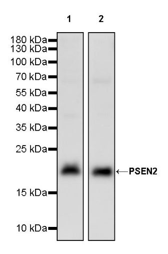 PSEN2 Recombinant Rabbit mAb (S-2084-14)