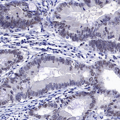 MLH1 Recombinant Mouse mAb (SDT-R702)