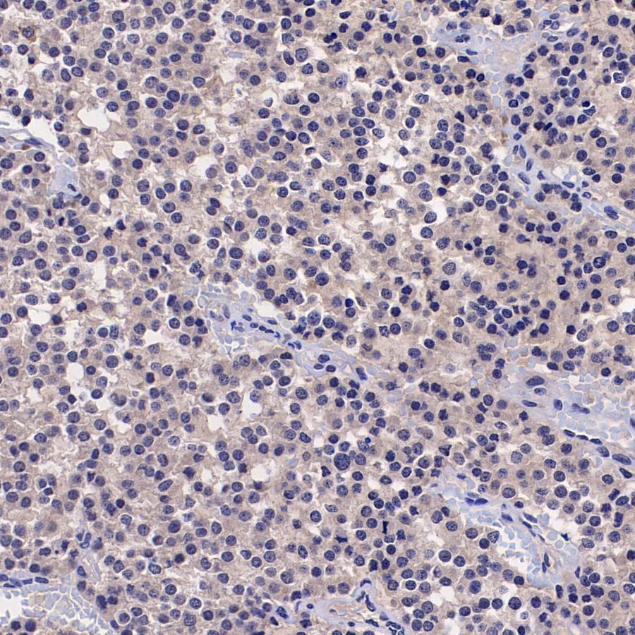 TREM2 Recombinant Rabbit mAb (S-5570)