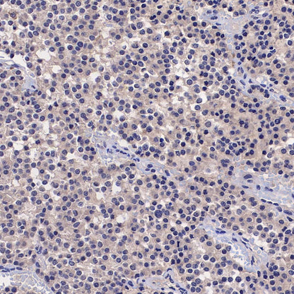 TREM2 Recombinant Rabbit mAb (S-5570)