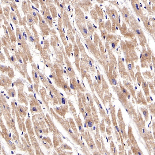 RIPK1 Rabbit Polyclonal Antibody