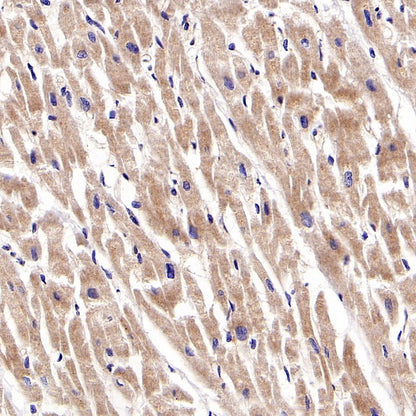 RIPK1 Rabbit Polyclonal Antibody