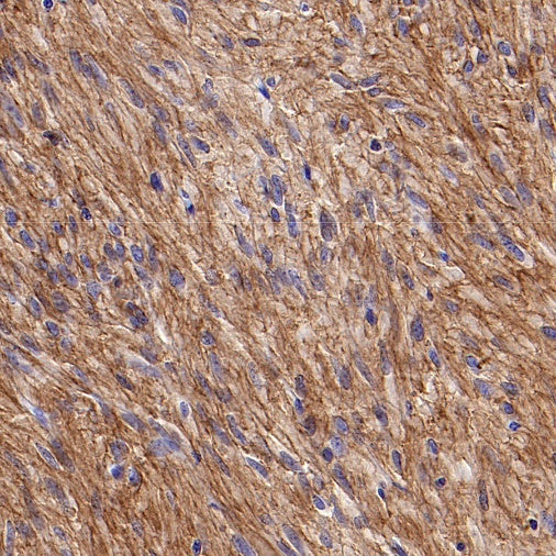 TMEM16A Recombinant Rabbit mAb (SDT-2179-12)