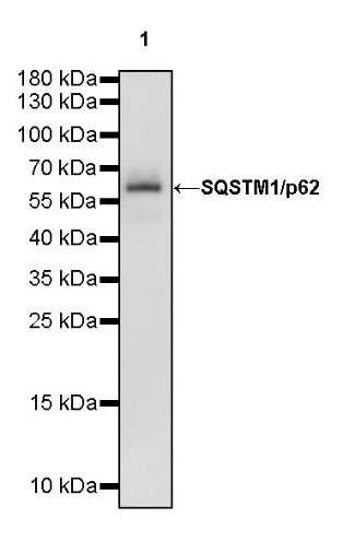 SQSTM1/p62 Recombinant Rabbit mAb (S-778-1)
