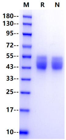 IL-10 R alpha/CD210 His Tag Protein, Human