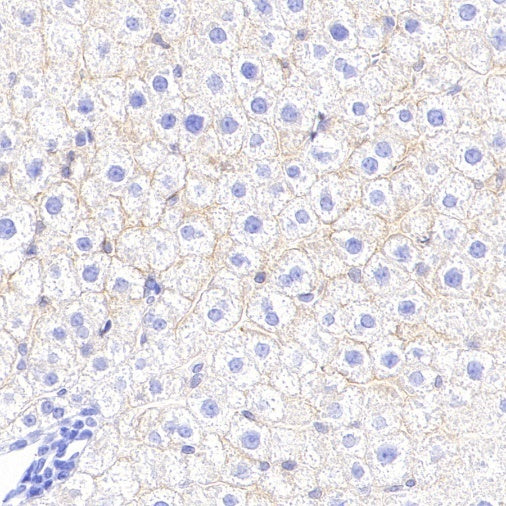 STEAP3 Recombinant Rabbit mAb (S-4466-26)
