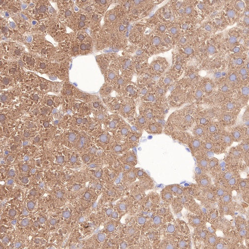 COX2 Recombinant Rabbit mAb (S-870-18)