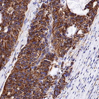 IDH2 Recombinant Rabbit mAb (S-1525-5)