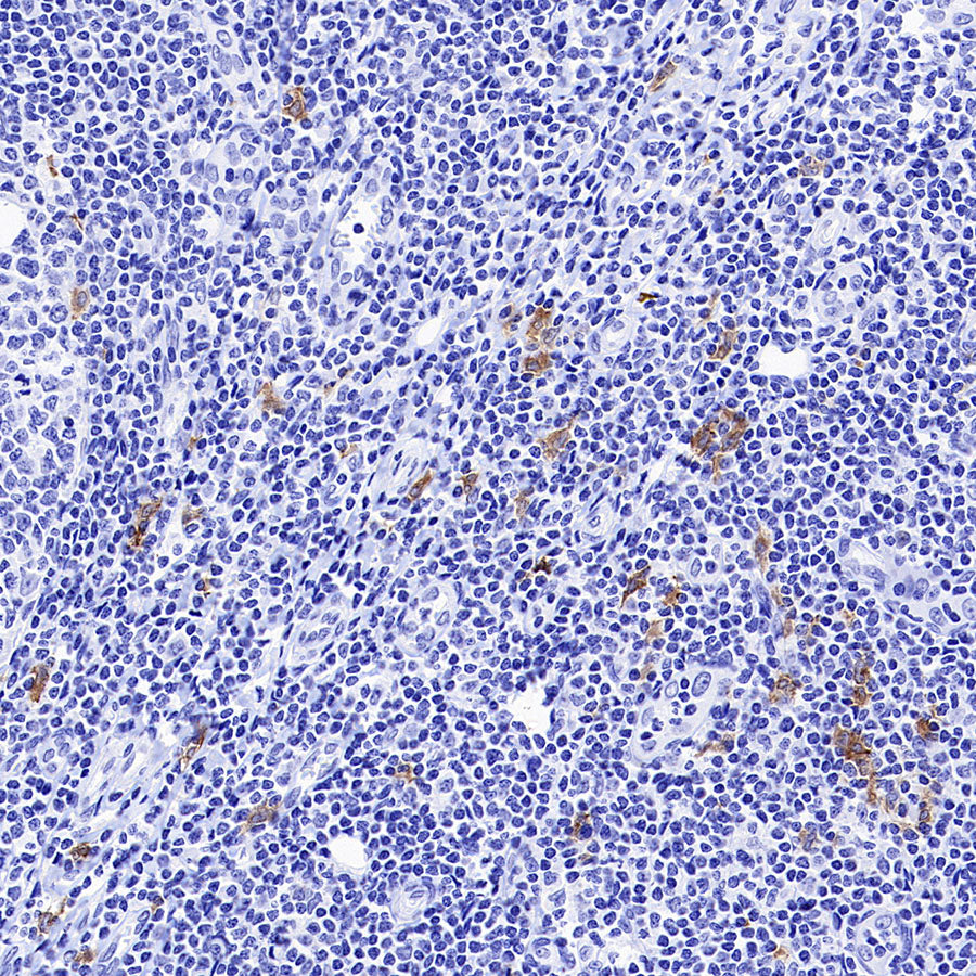 CLEC9A Recombinant Rabbit mAb (S-1904-154)