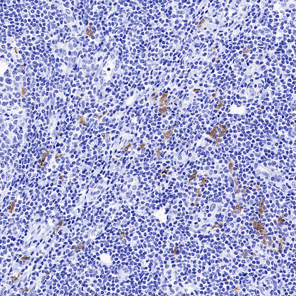 CLEC9A Recombinant Rabbit mAb (S-1904-154)