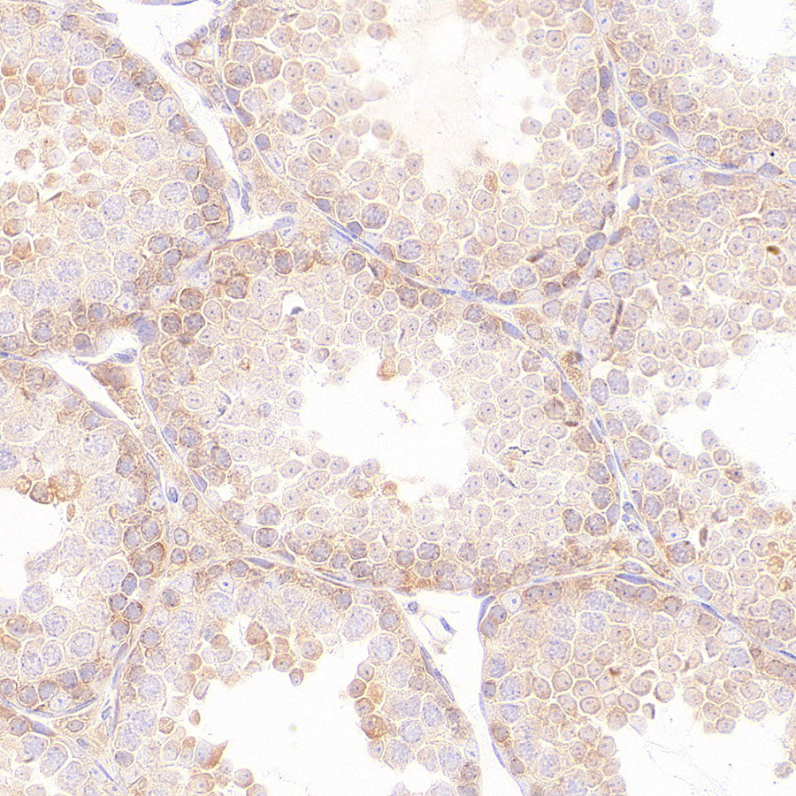 EIF2S2 Rabbit Polyclonal Antibody