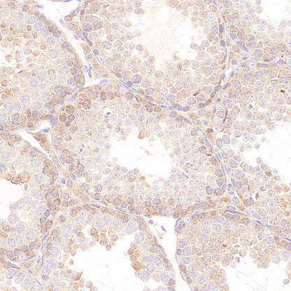 EIF2S2 Rabbit Polyclonal Antibody