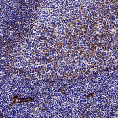 CD73 Recombinant Rabbit mAb (SDT-218-52)