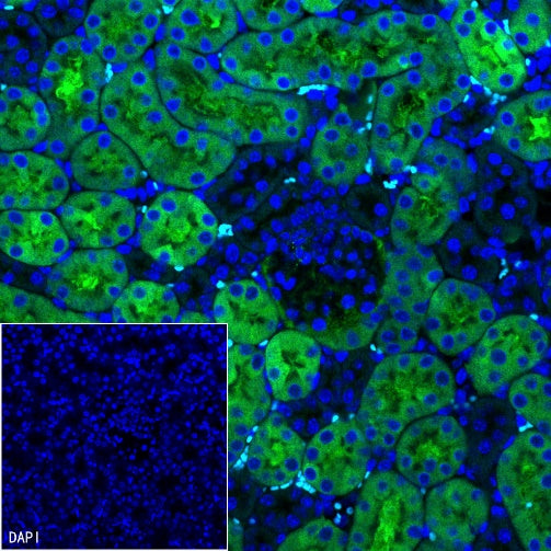 CBS Rabbit Polyclonal Antibody