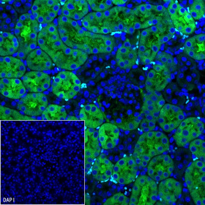 CBS Rabbit Polyclonal Antibody