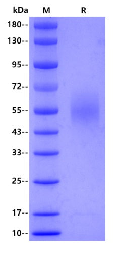 Human MICA protein, His tag