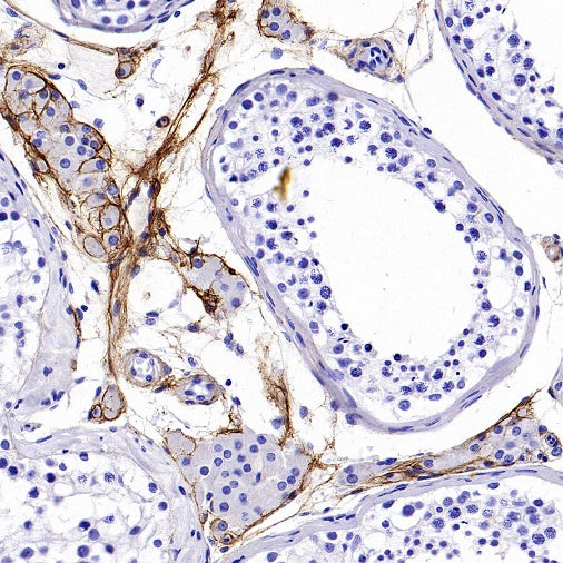 Collagen I Recombinant Rabbit mAb (S-1473-5)