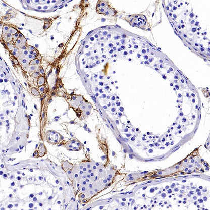 Collagen I Recombinant Rabbit mAb (S-1473-5)