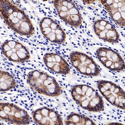 Anti-Rabbit HRP-DAB IHC detection kit