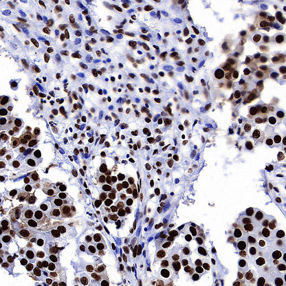 RBBP4 Rabbit Polyclonal Antibody