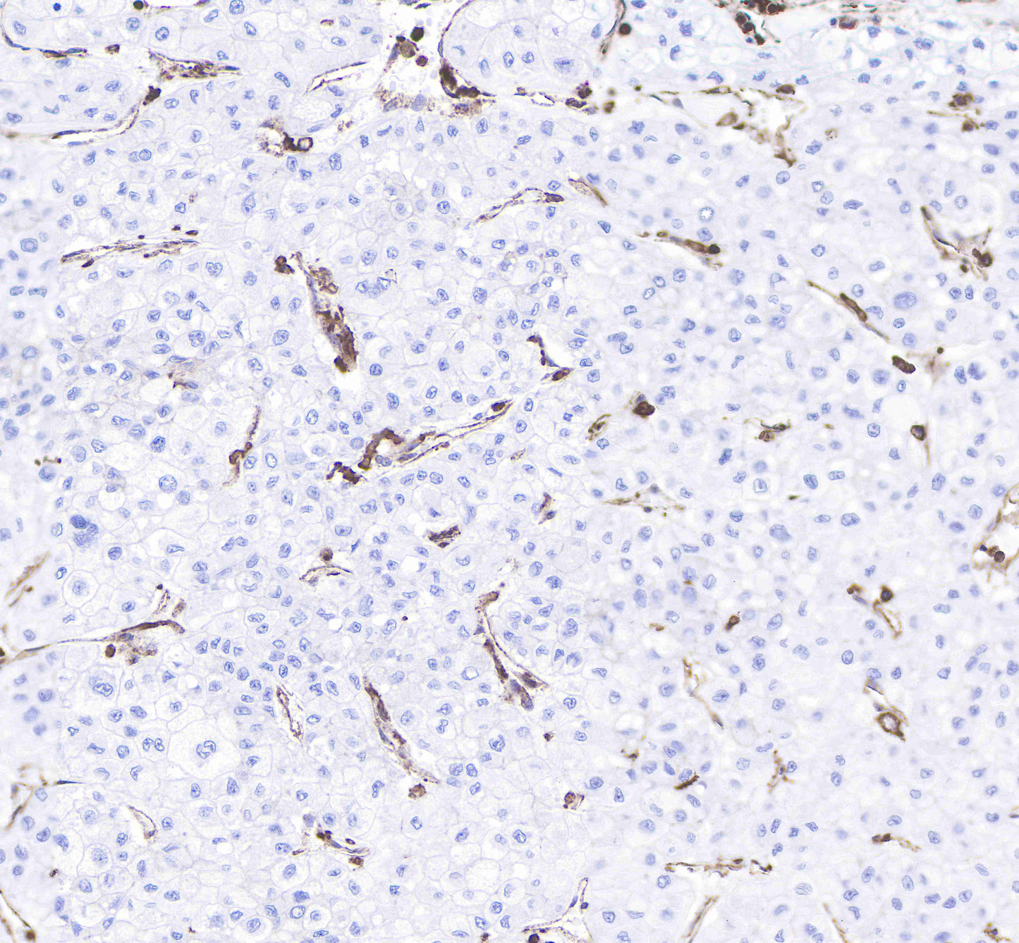 CD206 Recombinant Rabbit mAb(SDT-022-2)
