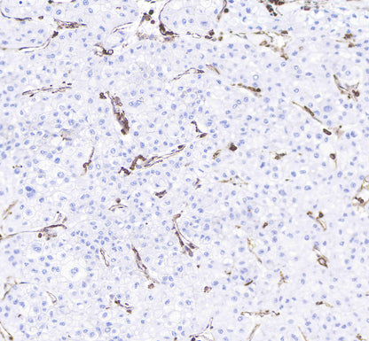 CD206 Recombinant Rabbit mAb(SDT-022-2)