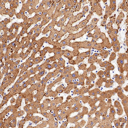 SERCA2 ATPase Recombinant Rabbit mAb (S-5956)