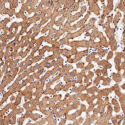 SERCA2 ATPase Recombinant Rabbit mAb (S-5956)