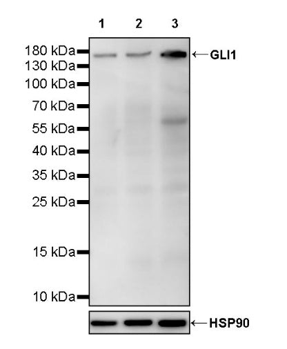 GLI1 Recombinant Rabbit mAb (S-2678-117)