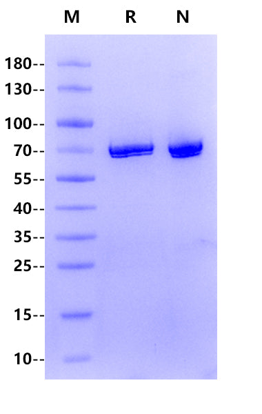 ACVR1C(ALK7) GST Tag Protein, Human