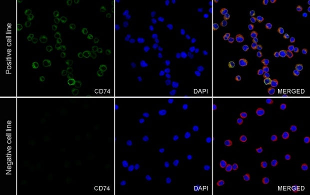 CD74 Recombinant Rabbit mAb (S-4524-58)