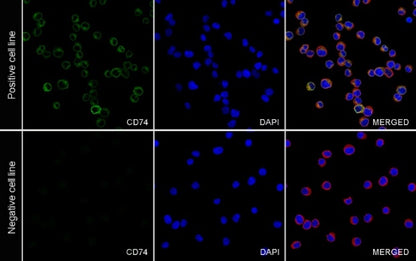 CD74 Recombinant Rabbit mAb (S-4524-58)