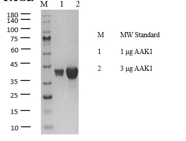 AAK1 His Tag Protein, Human