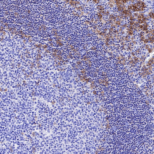 FcγRIIB Recombinant Rabbit mAb (S-R335)