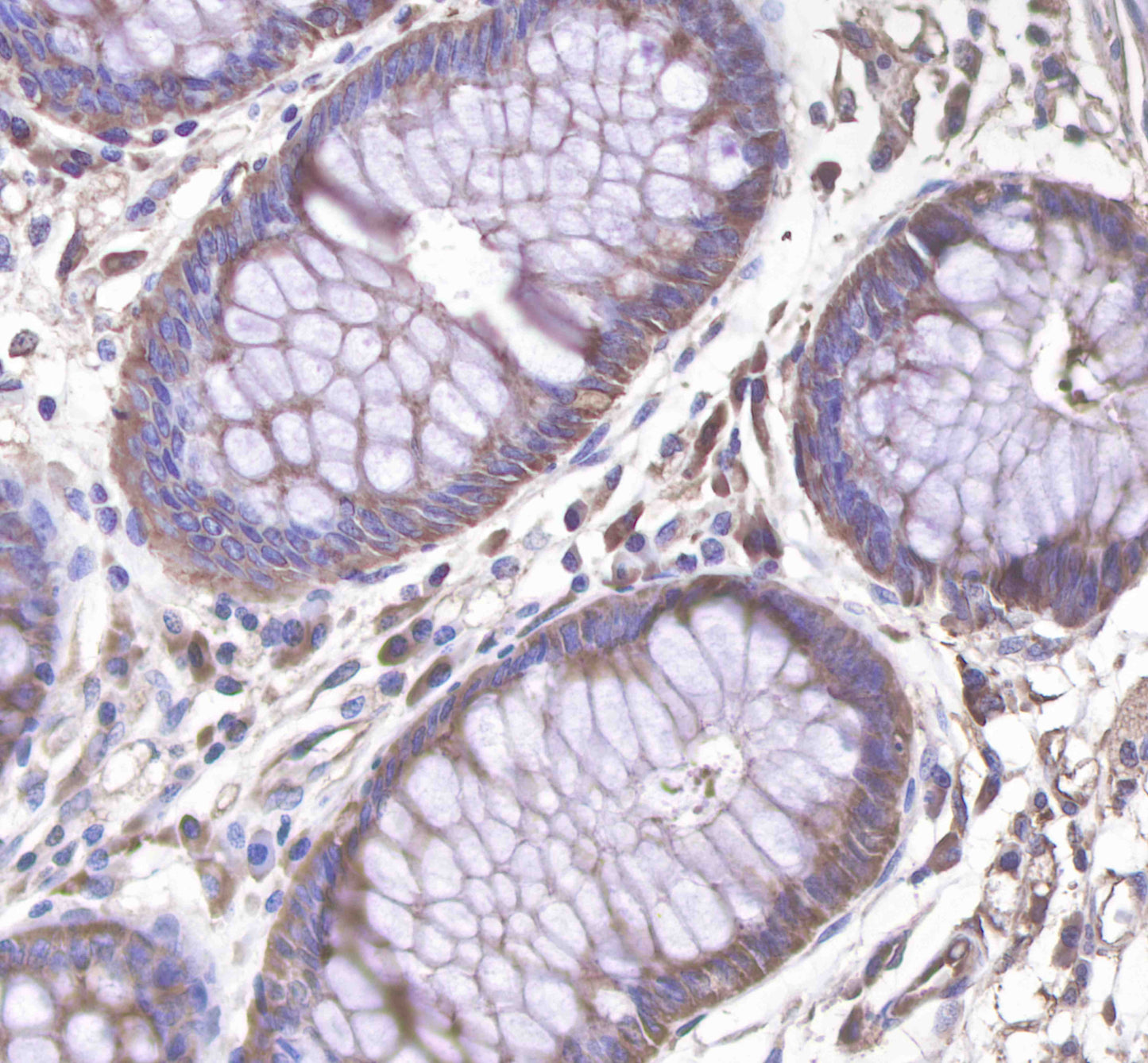 c-Met Rabbit mAb(SDT-009-7-2)