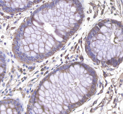 c-Met Rabbit mAb(SDT-009-7-2)