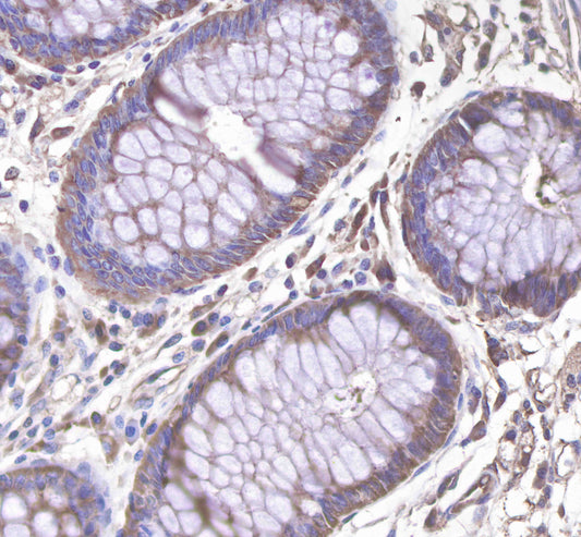 c-Met Rabbit mAb(SDT-009-7-2)