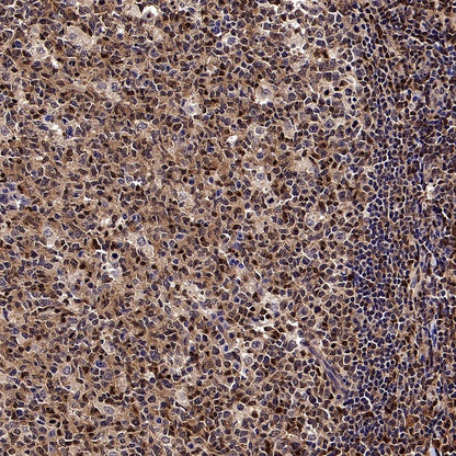 Stat5 Recombinant Rabbit mAb (S-2823-24)