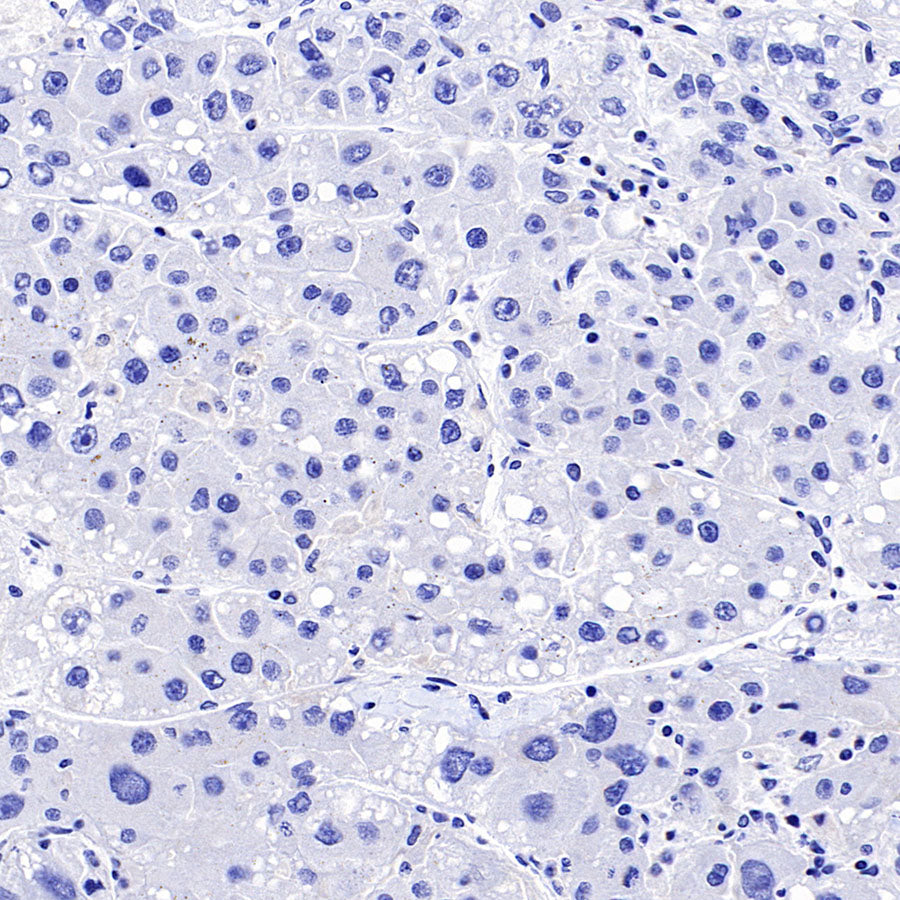 ARR3 Recombinant Rabbit mAb (S-3290-27)