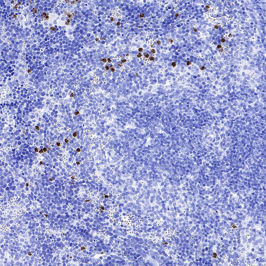 MMP9 Recombinant Rabbit mAb (S-3915-36)