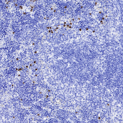 MMP9 Recombinant Rabbit mAb (S-3915-36)