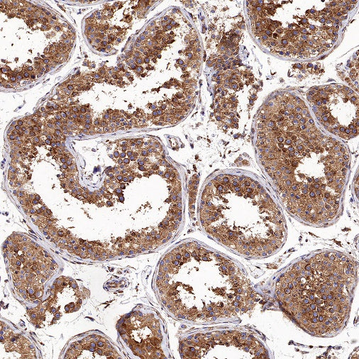 Clathrin heavy chain Recombinant Rabbit mAb (S-1690-25)
