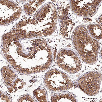 Clathrin heavy chain Recombinant Rabbit mAb (S-1690-25)