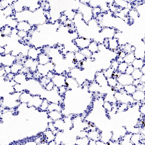 Lipocalin-2/NGAL Recombinant Rabbit mAb (S-2280-129)