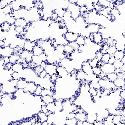 Lipocalin-2/NGAL Recombinant Rabbit mAb (S-2280-129)