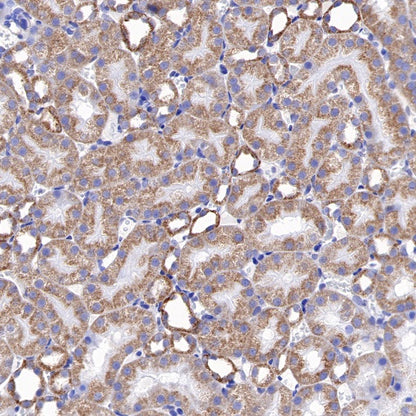 Bad Recombinant Rabbit mAb (S-976-26)
